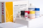 Inwestycja w produkcję zestawów immunoenzymatycznych